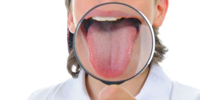 Deteksi Gangguan Kesehatan Melalui Lidah