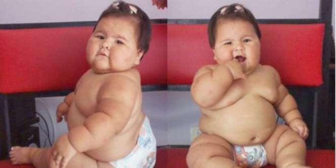 Usia Belum Setahun, Bayi Ini Berbobot 20 Kilogram