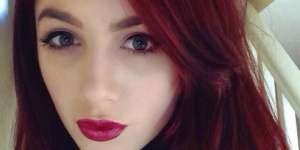 Gadis Cantik Ini Tak Minder Meski Hidup dengan Kantong Feses