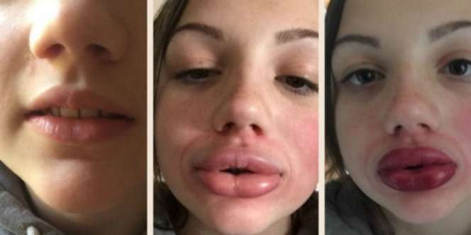 Tergiur Tantangan Bibir Sensual Berujung Bencana