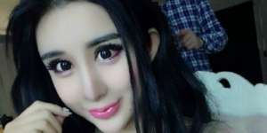 Cantik Berkat Operasi Plastik, Gadis Ini Dijuluki Hantu Ular