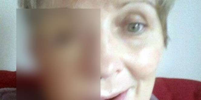 Kisah Pilu Ibu Berwajah Separuh