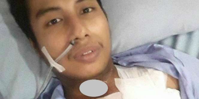 Pria Ini Tidak Bisa Bicara Karena Rokok