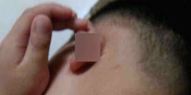 Sadis! Guru Staples Telinga Murid TK 