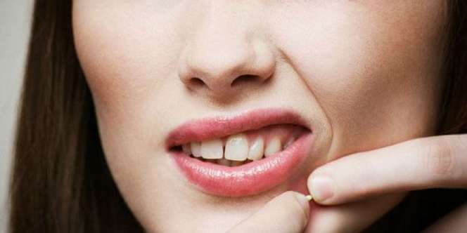 Tips Mengatasi Wajah Berjerawat