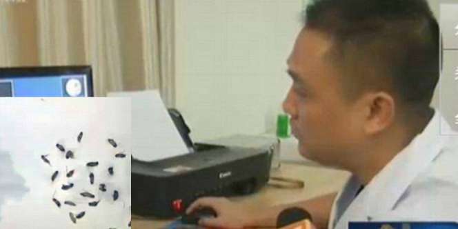 Mengerikan, 25 Kecoa Bersarang di Telinga