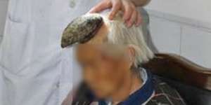 Nenek Ini Miliki Tanduk Di Kepalanya Seperti Unicorn