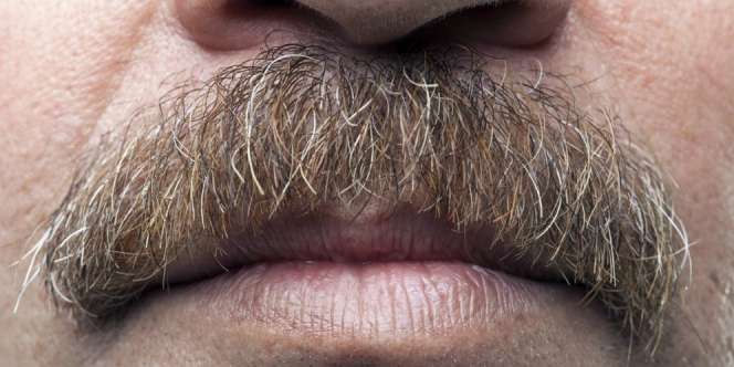 Tak Tahan Kumis Suami, Istri Minta Cerai