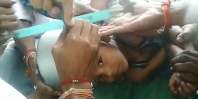 Akibat Iseng, Kepala Bocah Ini Terperangkap Panci Masak