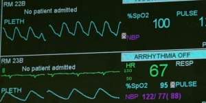 Inilah Teknologi Yang Katanya Mampu Memprediksi Kematian
