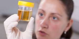 Benarkah Minum Urin Sendiri Bisa Sembuhkan Penyakit Kronis?