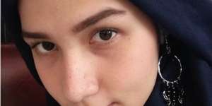 Tangkis Jerawat dengan Bahan Alami Ini