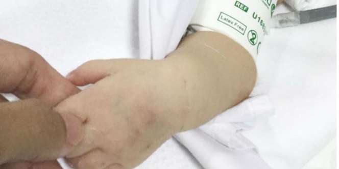 Komunitas Hijabers Galang Dukungan untuk Bayi Mungil Tabina