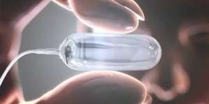 Pil Balon Bisa Tahan Nafsu Makan 4 Bulan Bagi Yang Ingin Kurus