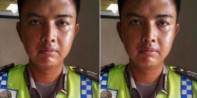 Tak Terima Ditilang, Ibu Cakar Wajah Polantas di Kelapa Gading