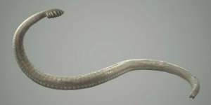 Meregang Nyawa Akibat Cacing di Tubuh