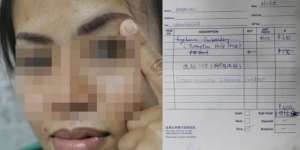 Sulam Alis di Singapura, TKI Ditarik Rp 7,8 Juta