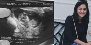 Hamil, Ayudia Bing Slamet Sebut `Si Kacang` untuk Calon Bayi