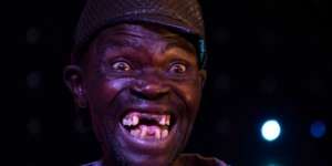 Orang Paling Jelek Ini Dianggap Masih Terlalu Tampan