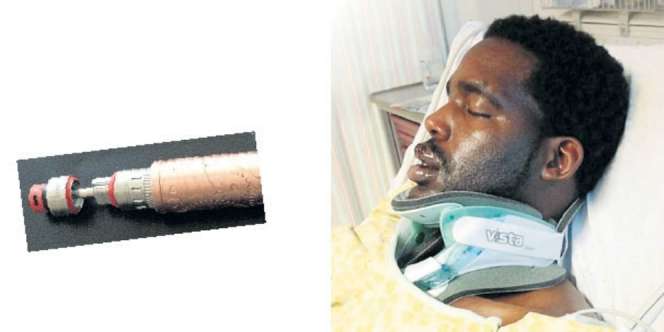 Rokok Elektrik Meledak di Mulut, Leher Patah