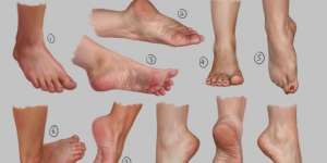 Cara Diagnosa Kondisi Kesehatan Lewat Kaki