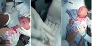 Heboh! Bayi Telan Jam, Dokter Keluarkan Dengan Tangan Kosong