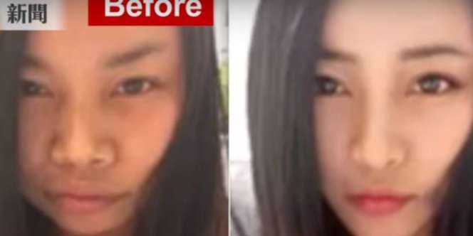 Heboh 'Obat' Cantik dan Ganteng Para Alay di Sosial Media