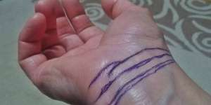 Arti Garis Gelang di Pergelangan Tangan Kita