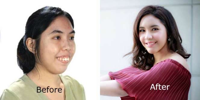 Ikut Program TV, Wajah Wanita Ini Disulap Jadi Cantik