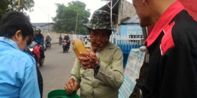 Semangat Urip, Tetap Bersyukur di Tengah Kelainan
