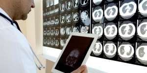 Tak Cuma Lansia, Anak Muda Juga Bisa Terserang Pikun