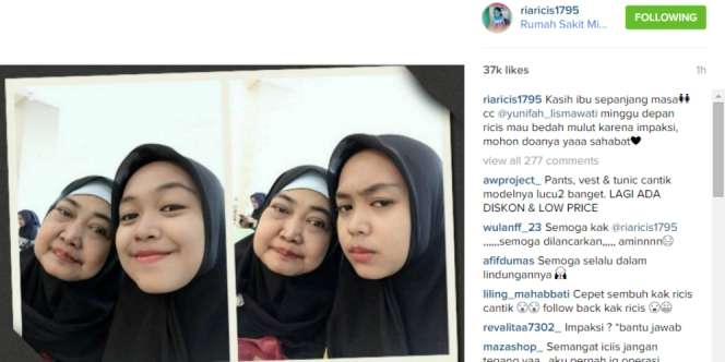 Ria Ricis Jalani Operasi Bedah Mulut