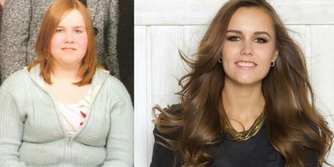 Bungkam Haters! Perubahan Gadis 107 Kg Bikin Geger