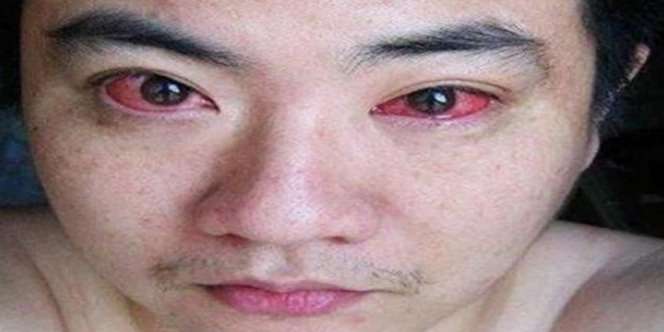Sering Lihat Handphone Setiap Malam, Mata Lelaki Itu...