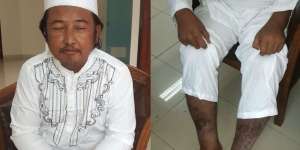 Kesehatan Memprihatinkan Ayah Marshanda Selama Mengemis