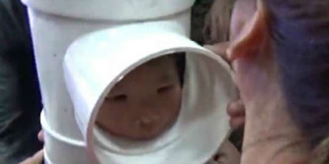 Ditinggal Sendirian, Kepala Bocah Ini Terjepit dalam Pipa