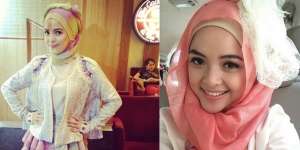 Cerita Tasya Kamila Alami Alergi Kulit