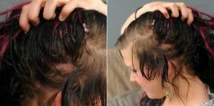 Bahaya Mengerikan Pakai Rambut Sambungan
