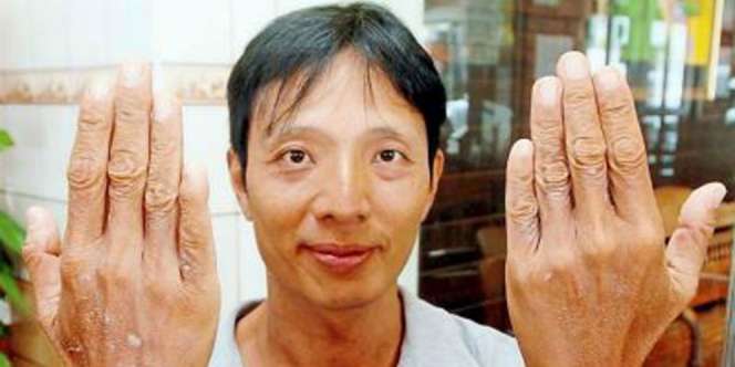 Bau Balsem Misterius Akhiri Derita 9 Hari Hilang di Lautan