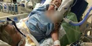 Foto Mengharukan Suami Pamit ke Istri Sebelum Meninggal