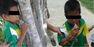 Innalillahi... Bibir Bocah Ini Digigit Tokek, Tak Bisa Dilepas