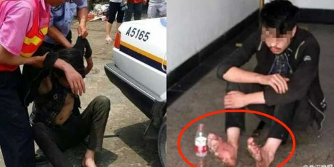 Kaki Pemuda Melepuh Setelah Kecanduan Games Online