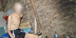 Penderitaan Kakek Pengidap Kanker Kulit Diusir Keluarga