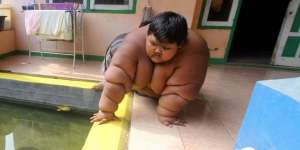 Bocah Tergemuk Asal Indonesia Disorot Dunia