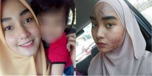 Bahaya Mengerikan Produk Kecantikan, Wajah Cantik Itu Jadi...