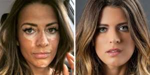 Di Balik Wajah Cantiknya, Model Ini Ungkap Rahasia Mengejutkan