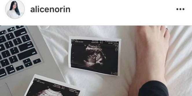 Penantian 5 Tahun, Alice Norin Hamil Anak Pertama