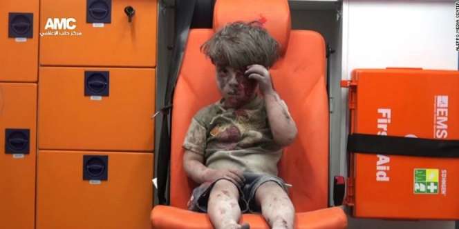 Tak Mampu Bertahan, Kakak Omran Daqneesh Meninggal Dunia