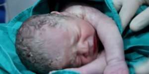 Subhanallah, Bayi Lahir dari Ibu Korban Bom