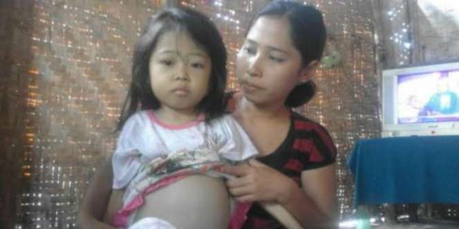Benjolan Besar di Perut, Gadis Cilik Ternyata....